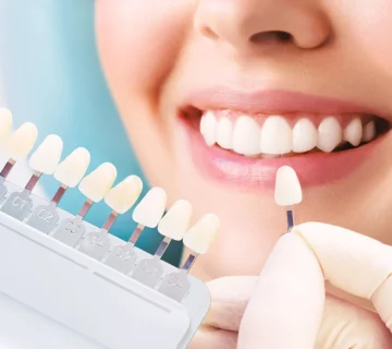 zirkonyum-kaplama-mi-porselen-mi-2