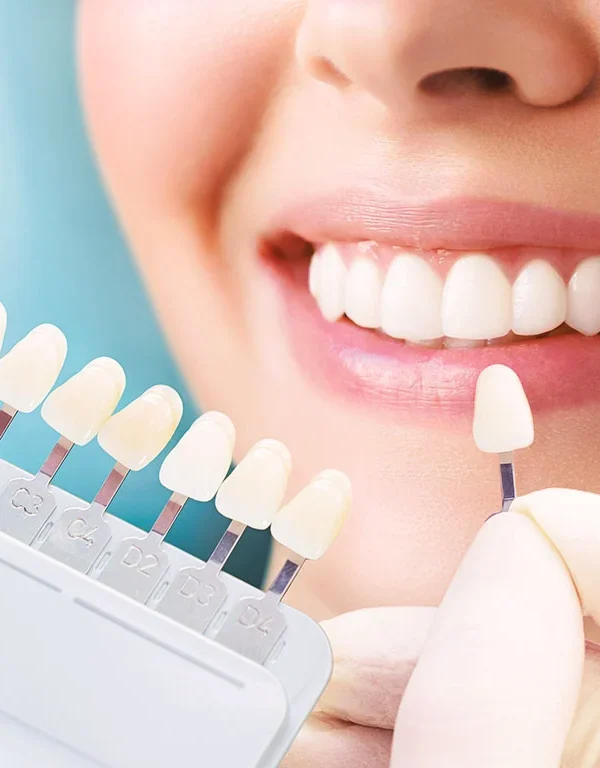 zirkonyum-kaplama-mi-porselen-mi-2