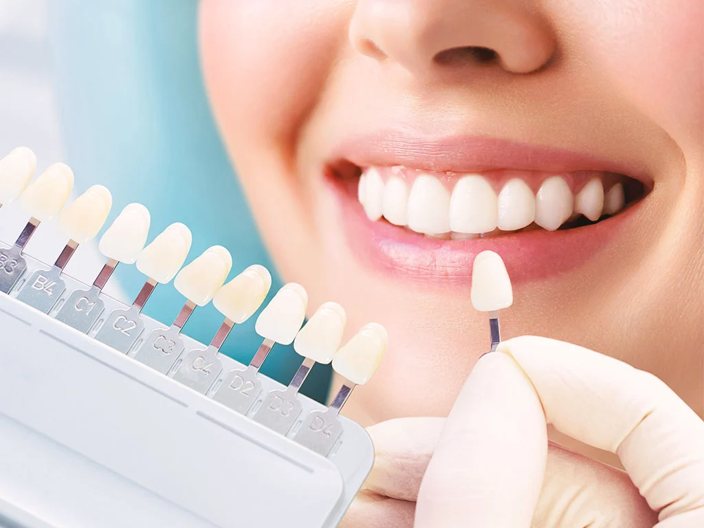 zirkonyum-kaplama-mi-porselen-mi-2